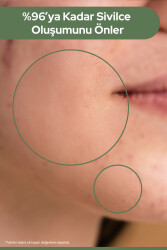 Çay Ağacı Yağı Özlü, Akne, Sivilce ve Siyah Nokta Leke Karşıtı SOS Serum 10ml - 4